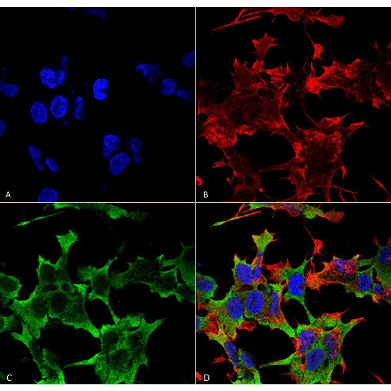 Immunocytochemistry/Immunofluorescence - Anti-LAR Antibody [S165-38] (A305027) - Antibodies.com