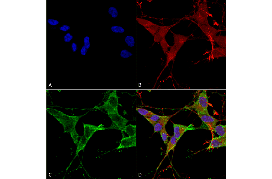 Immunocytochemistry/Immunofluorescence - Anti-LAR Antibody [S165-38] (A305027) - Antibodies.com