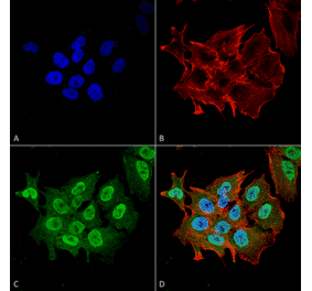 Immunocytochemistry/Immunofluorescence - Anti-Ataxin 1 Antibody [S76-8] (A305028) - Antibodies.com