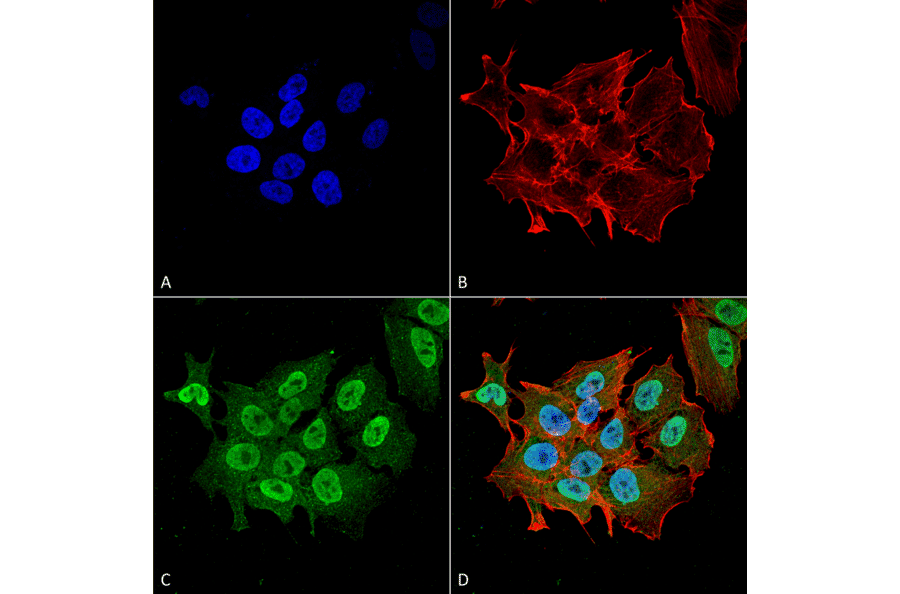 Immunocytochemistry/Immunofluorescence - Anti-Ataxin 1 Antibody [S76-8] (A305028) - Antibodies.com