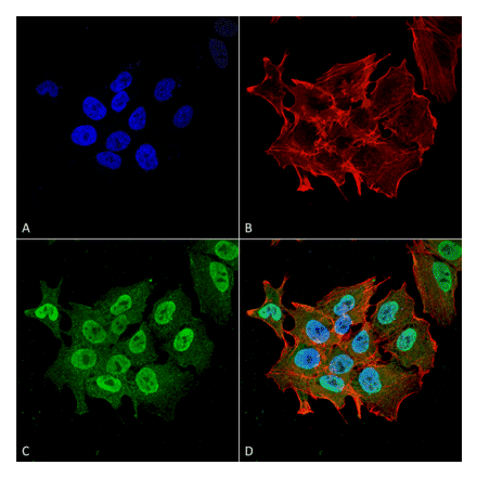 Immunocytochemistry/Immunofluorescence - Anti-Ataxin 1 Antibody [S76-8] (A305028) - Antibodies.com