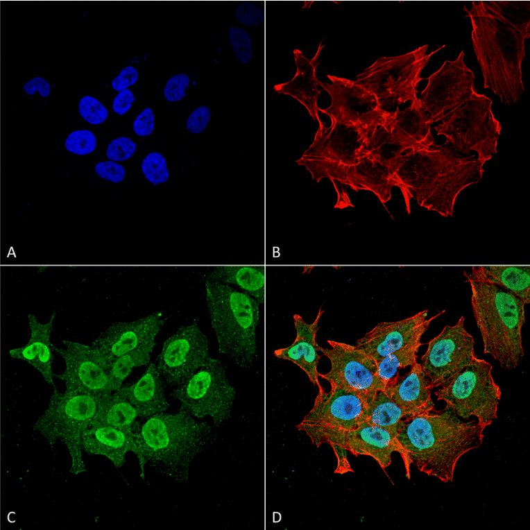 Immunocytochemistry/Immunofluorescence - Anti-Ataxin 1 Antibody [S76-8] (A305028) - Antibodies.com