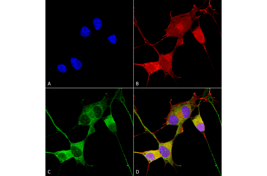 Immunocytochemistry/Immunofluorescence - Anti-Ataxin 1 Antibody [S76-8] (A305028) - Antibodies.com