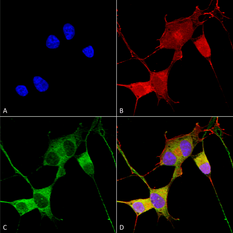 Immunocytochemistry/Immunofluorescence - Anti-Ataxin 1 Antibody [S76-8] (A305028) - Antibodies.com