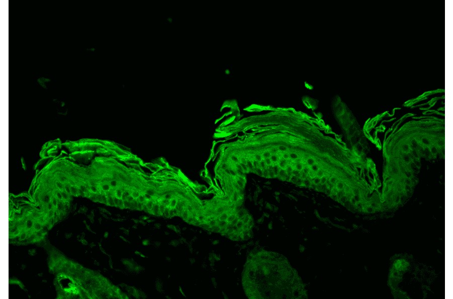 Immunohistochemistry - Anti-HSP90 Antibody (A305030) - Antibodies.com