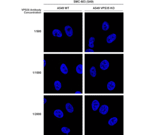 Immunocytochemistry/Immunofluorescence - Anti-VPS35 Antibody [5A9] (A305033) - Antibodies.com