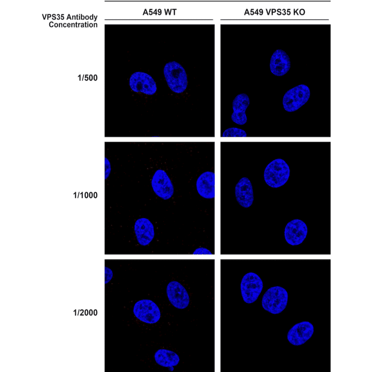 Immunocytochemistry/Immunofluorescence - Anti-VPS35 Antibody [5A9] (A305033) - Antibodies.com