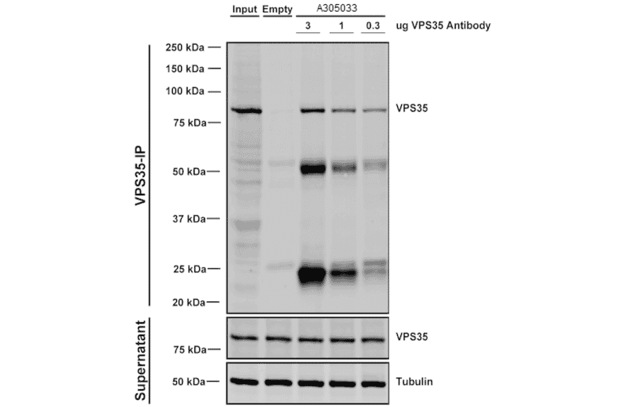 Immunoprecipitation - Anti-VPS35 Antibody [5A9] (A305033) - Antibodies.com