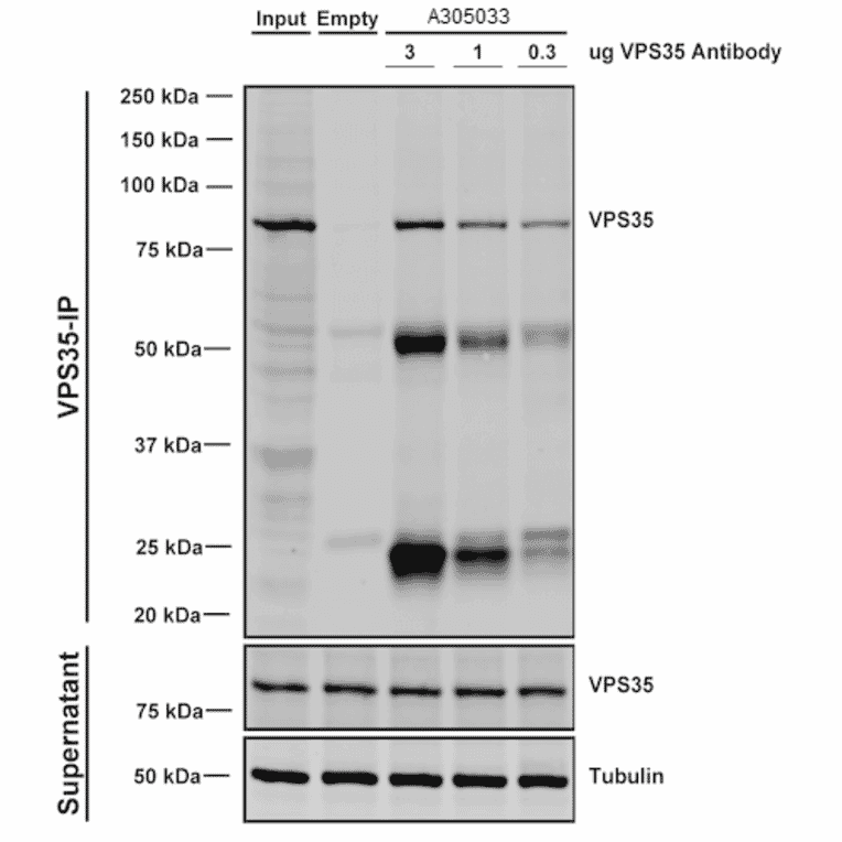 Immunoprecipitation - Anti-VPS35 Antibody [5A9] (A305033) - Antibodies.com