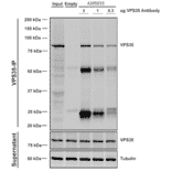 Immunoprecipitation - Anti-VPS35 Antibody [5A9] (A305033) - Antibodies.com