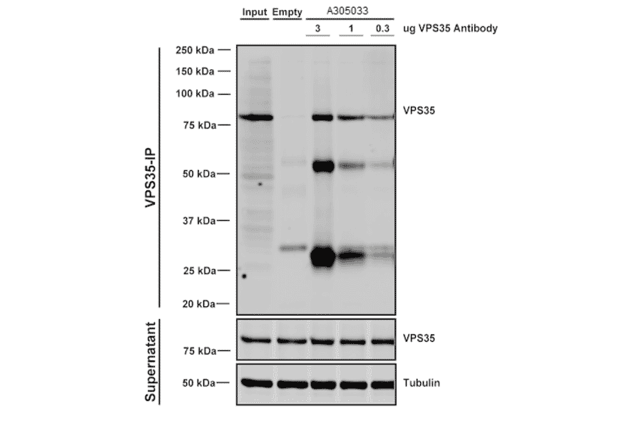 Immunoprecipitation - Anti-VPS35 Antibody [5A9] (A305033) - Antibodies.com