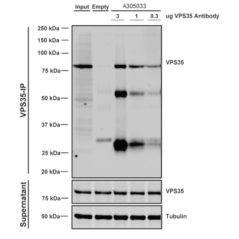 Immunoprecipitation - Anti-VPS35 Antibody [5A9] (A305033) - Antibodies.com