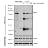 Immunoprecipitation - Anti-VPS35 Antibody [5A9] (A305033) - Antibodies.com