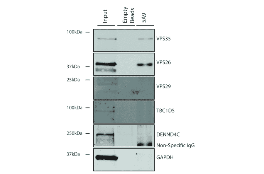 Immunoprecipitation - Anti-VPS35 Antibody [5A9] (A305033) - Antibodies.com