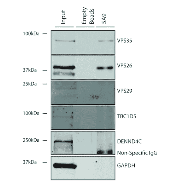 Immunoprecipitation - Anti-VPS35 Antibody [5A9] (A305033) - Antibodies.com