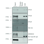 Immunoprecipitation - Anti-VPS35 Antibody [5A9] (A305033) - Antibodies.com