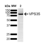 Western Blot - Anti-VPS35 Antibody [5A9] (A305033) - Antibodies.com