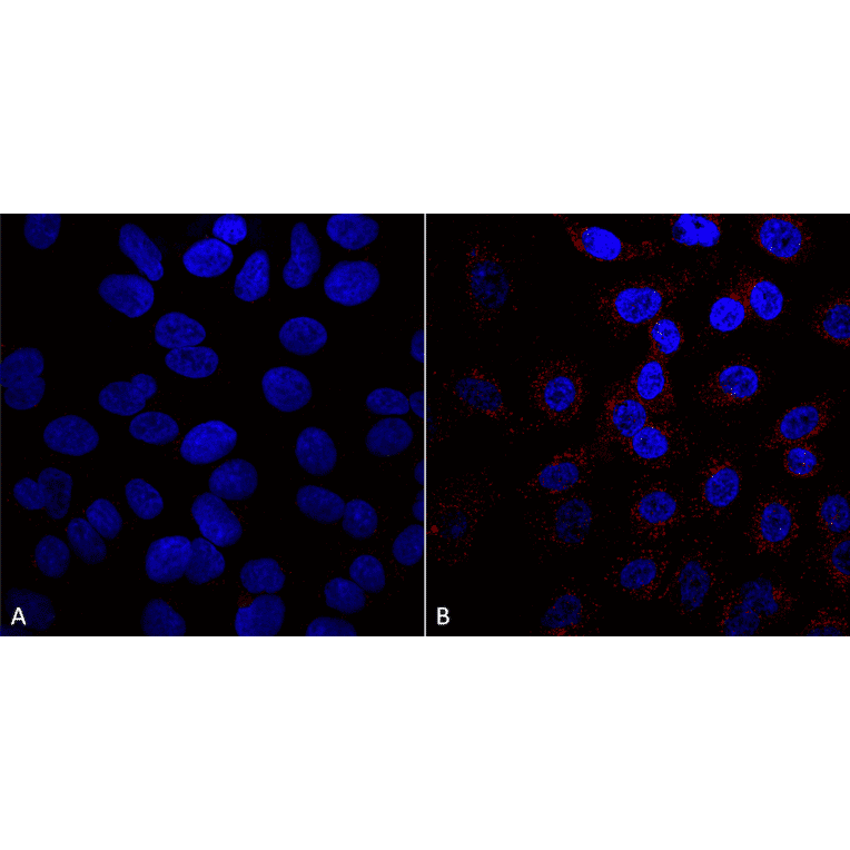 Immunocytochemistry/Immunofluorescence - Anti-VPS35 Antibody [5A9] (A305033) - Antibodies.com