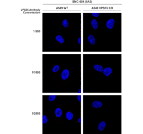 Immunocytochemistry/Immunofluorescence - Anti-VPS35 Antibody [8A3] (A305034) - Antibodies.com
