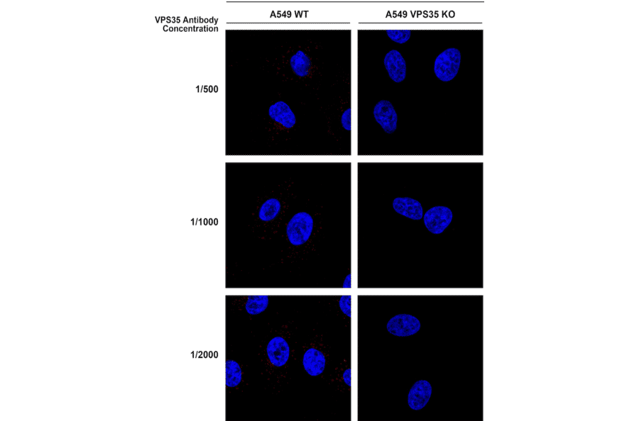 Immunocytochemistry/Immunofluorescence - Anti-VPS35 Antibody [8A3] (A305034) - Antibodies.com