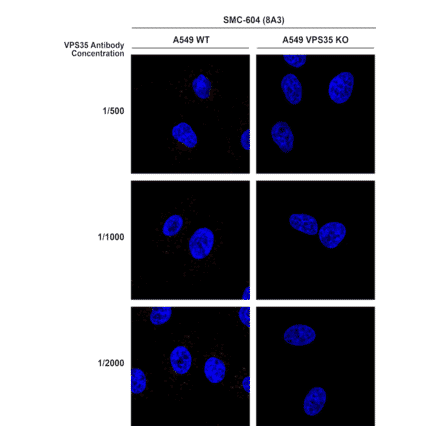 Immunocytochemistry/Immunofluorescence - Anti-VPS35 Antibody [8A3] (A305034) - Antibodies.com