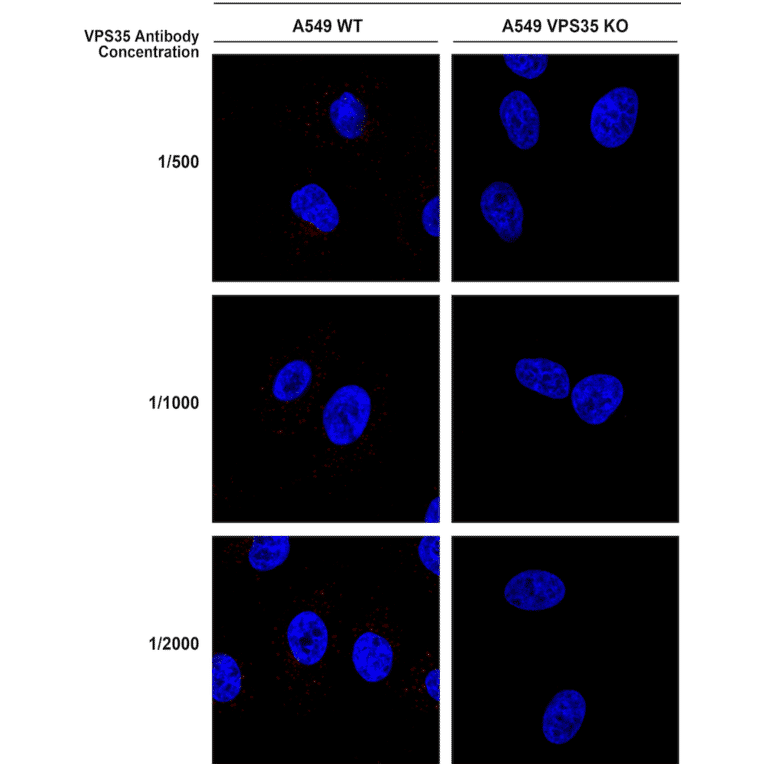 Immunocytochemistry/Immunofluorescence - Anti-VPS35 Antibody [8A3] (A305034) - Antibodies.com