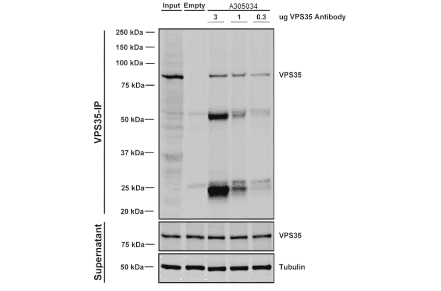 Immunoprecipitation - Anti-VPS35 Antibody [8A3] (A305034) - Antibodies.com