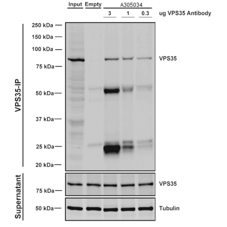 Immunoprecipitation - Anti-VPS35 Antibody [8A3] (A305034) - Antibodies.com