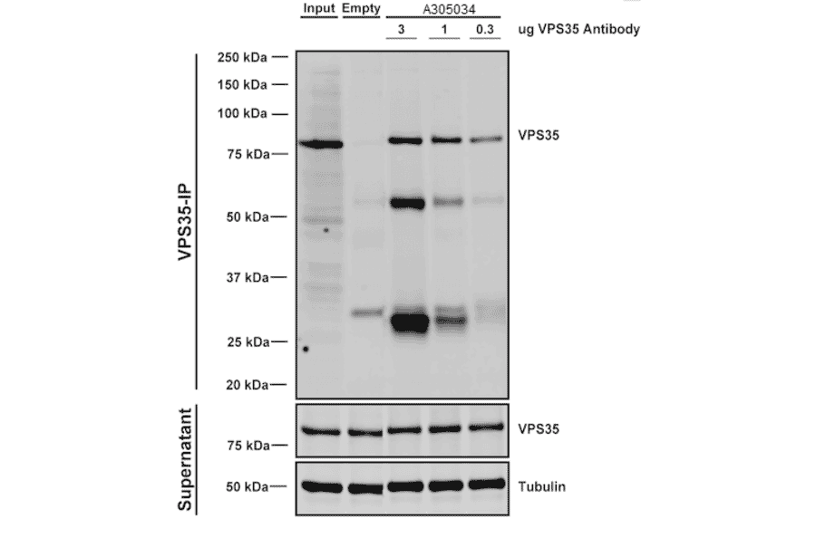 Immunoprecipitation - Anti-VPS35 Antibody [8A3] (A305034) - Antibodies.com