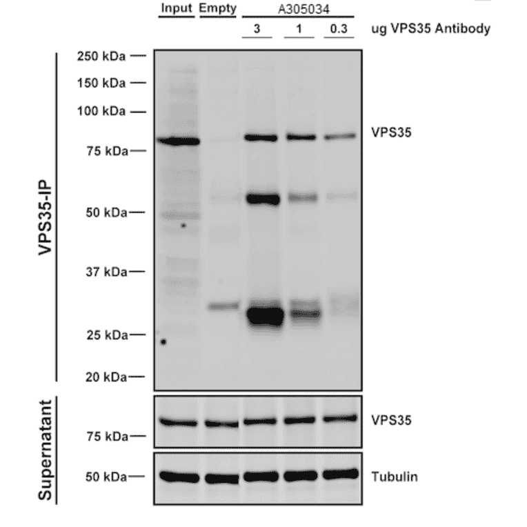 Immunoprecipitation - Anti-VPS35 Antibody [8A3] (A305034) - Antibodies.com