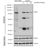 Immunoprecipitation - Anti-VPS35 Antibody [8A3] (A305034) - Antibodies.com