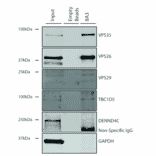 Immunoprecipitation - Anti-VPS35 Antibody [8A3] (A305034) - Antibodies.com