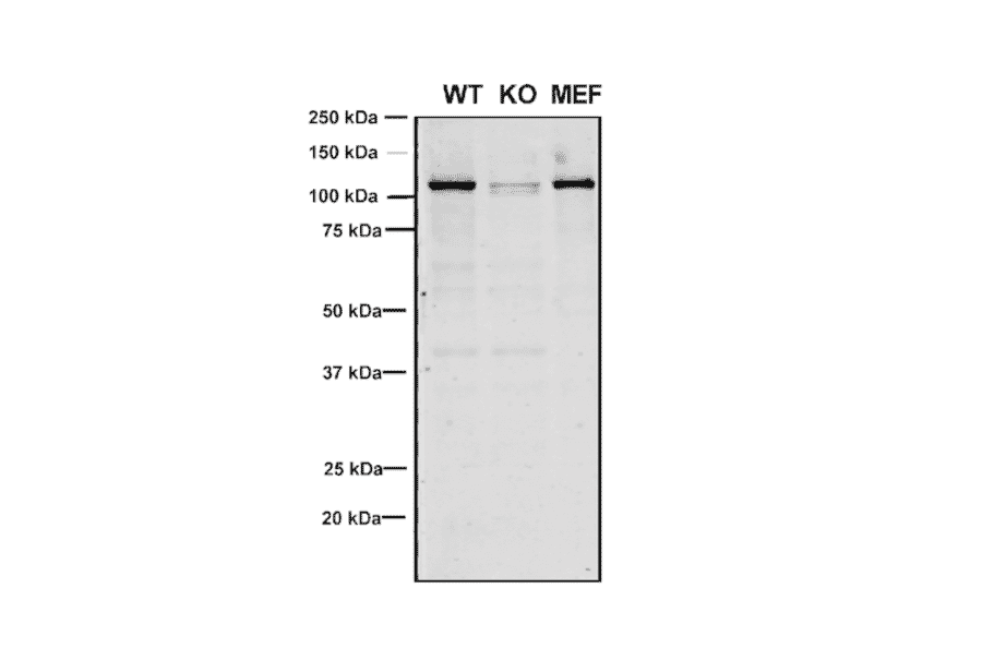 Western Blot - Anti-VPS35 Antibody [8A3] (A305034) - Antibodies.com