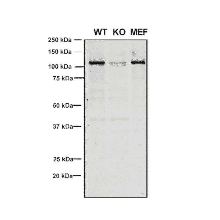 Western Blot - Anti-VPS35 Antibody [8A3] (A305034) - Antibodies.com