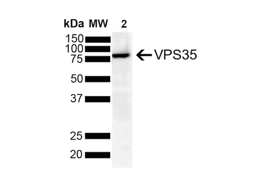 Western Blot - Anti-VPS35 Antibody [8A3] (A305034) - Antibodies.com