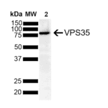 Western Blot - Anti-VPS35 Antibody [8A3] (A305034) - Antibodies.com
