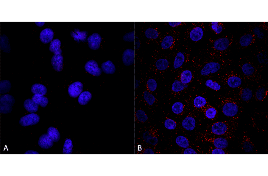 Immunocytochemistry/Immunofluorescence - Anti-VPS35 Antibody [8A3] (A305034) - Antibodies.com