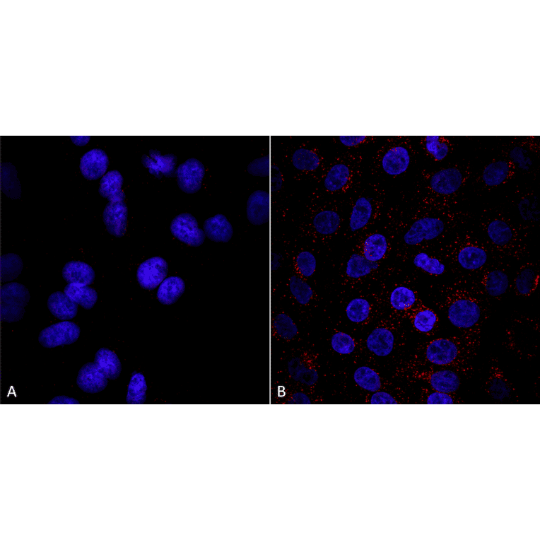 Immunocytochemistry/Immunofluorescence - Anti-VPS35 Antibody [8A3] (A305034) - Antibodies.com