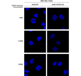 Immunocytochemistry/Immunofluorescence - Anti-VPS35 Antibody [10A8] (A305035) - Antibodies.com