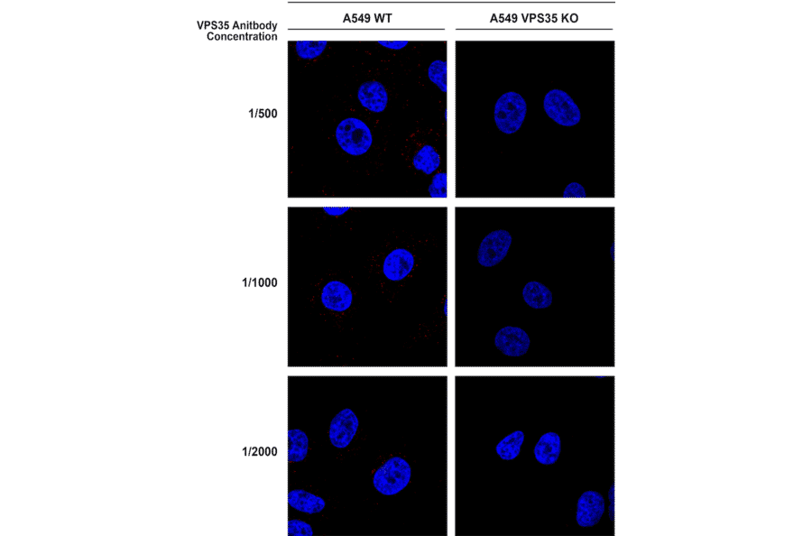 Immunocytochemistry/Immunofluorescence - Anti-VPS35 Antibody [10A8] (A305035) - Antibodies.com