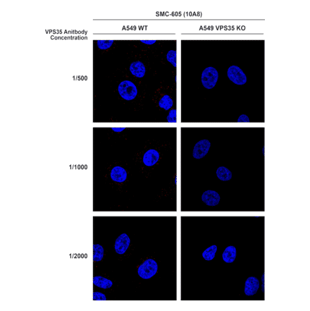 Immunocytochemistry/Immunofluorescence - Anti-VPS35 Antibody [10A8] (A305035) - Antibodies.com