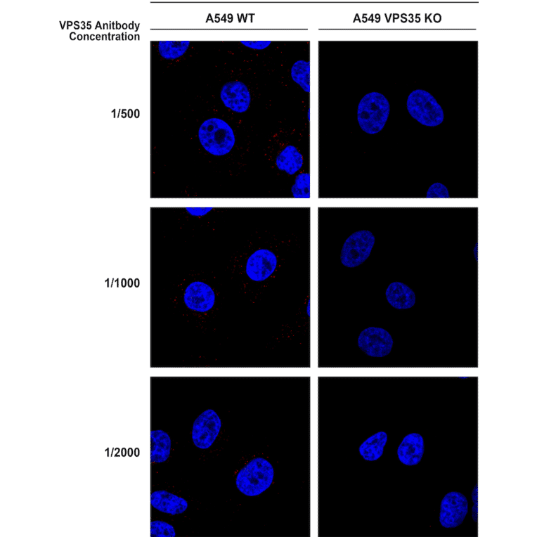 Immunocytochemistry/Immunofluorescence - Anti-VPS35 Antibody [10A8] (A305035) - Antibodies.com