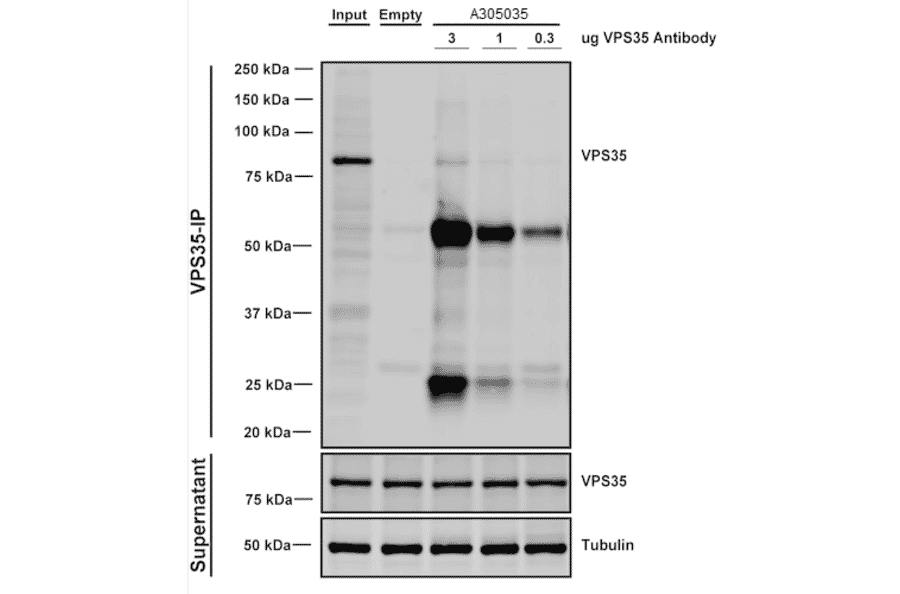 Immunoprecipitation - Anti-VPS35 Antibody [10A8] (A305035) - Antibodies.com