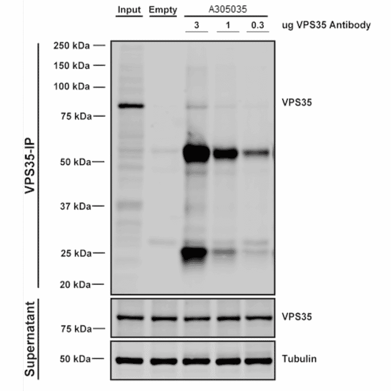 Immunoprecipitation - Anti-VPS35 Antibody [10A8] (A305035) - Antibodies.com