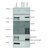 Immunoprecipitation - Anti-VPS35 Antibody [10A8] (A305035) - Antibodies.com