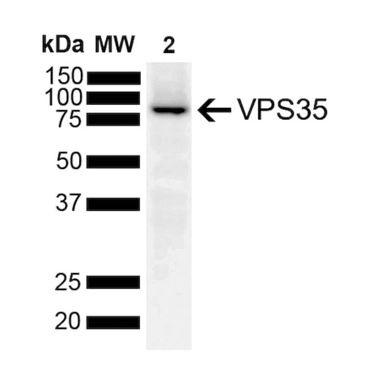 Western Blot - Anti-VPS35 Antibody [10A8] (A305035) - Antibodies.com