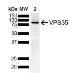 Western Blot - Anti-VPS35 Antibody [10A8] (A305035) - Antibodies.com