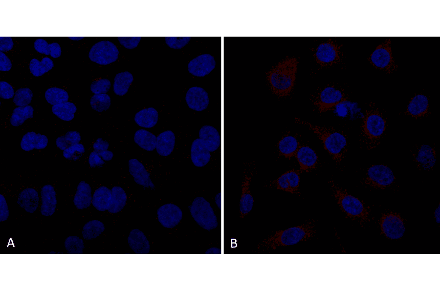 Immunocytochemistry/Immunofluorescence - Anti-VPS35 Antibody [10A8] (A305035) - Antibodies.com