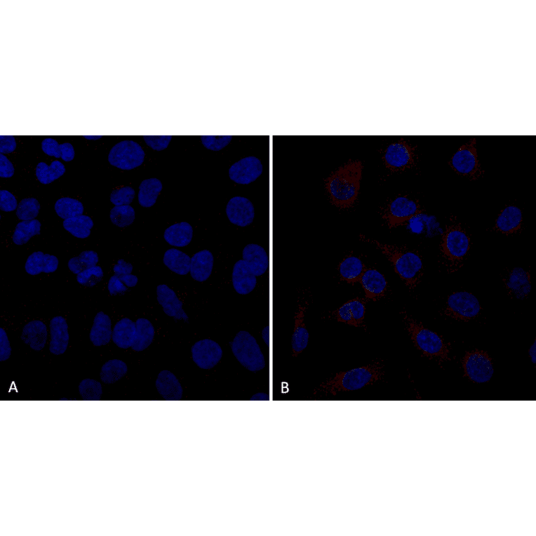 Immunocytochemistry/Immunofluorescence - Anti-VPS35 Antibody [10A8] (A305035) - Antibodies.com