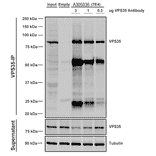 Immunoprecipitation - Anti-VPS35 Antibody [7E4] (A305036) - Antibodies.com